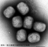 「エムポックス」長野県内で初の感染確認　全国で今年8人が感染　ウイルス性の急性発疹性疾患　県内の医療機関を受診した1人|TBS NEWS DIG