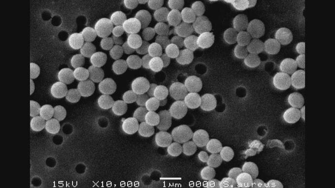 【黄色ブドウ球菌】常に手指・顔などにいる恐れ “家庭でも注意を” 土用の丑の日のうなぎで集団食中毒　|　名古屋・愛知・岐阜・三重のニュース【CBC news】 | CBC web