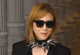 YOSHIKIさん 「首の手術後、今は歩けるようになりました」 投稿画像にファン反響 「トゲトゲのコルセットが似合う」|TBS NEWS DIG