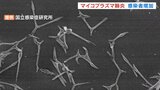 マイコプラズマ肺炎の感染者数　急増した8月からいまだ増加傾向続く　富山　|　富山のニュース｜天気・防災｜チューリップテレビ