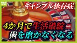 【ギャンブル依存症】歯を磨かなくなる！？うつ病を合併することも...圧倒的に"生活の破綻"が早い『オンラインカジノ』　依存症克服には「怒らない仲間」「成功体験」【専門家解説】|TBS NEWS DIG