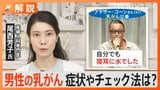 “1000人に1人”男性の乳がん 症状やチェック法は? 歌手ブラザー・コーンさん乳がん公表「寝耳に水でした」【Nスタ解説】|TBS NEWS DIG