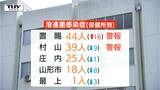 子ども中心に流行「手足口病」 県内でも患者数増加 溶連菌は置賜・村山で警報レベル続く(山形)|TBS NEWS DIG