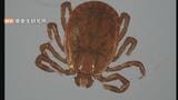 80代女性がマダニ媒介「SFTS」に感染 富山県で2例目の感染確認 農作業やレジャー、野外活動時は対策を | 富山のニュース|天気・防災|チューリップテレビ