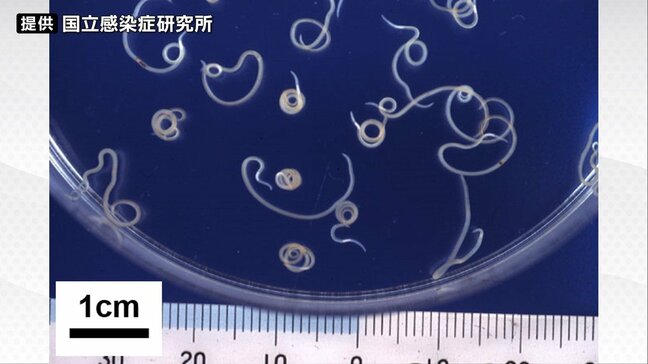 宮城県内では2026年初の"アニサキス食中毒"　塩釜の回転寿司店で冷凍品除く、生食用魚介類の提供を1日間停止|TBS NEWS DIG