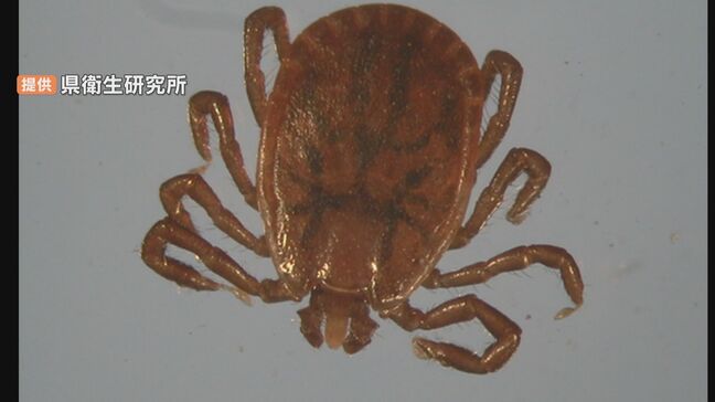80代女性がマダニ媒介「SFTS」に感染　富山県で2例目の感染確認　農作業やレジャー、野外活動時は対策を|TBS NEWS DIG