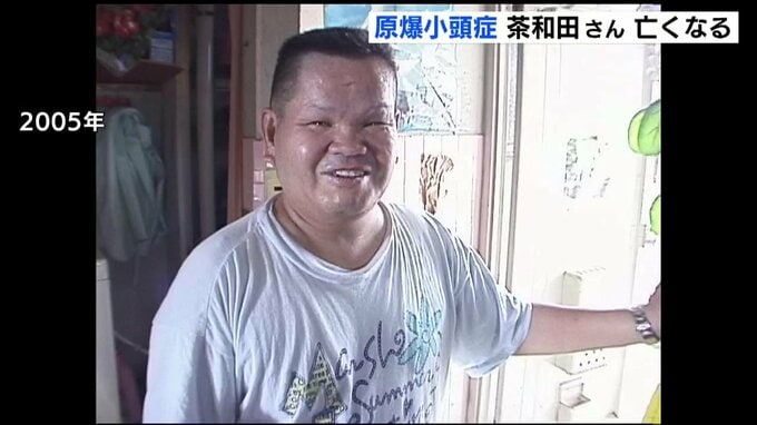 原爆小頭症の茶和田武亜さん死去（広島）|TBS NEWS DIG
