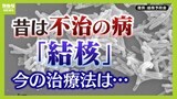 今も年間１万人以上が感染　せきや体のだるさが続いたら要注意？令和に知っておきたい『結核』の脅威と症状　発症のカギを握るのは「免疫力」|TBS NEWS DIG