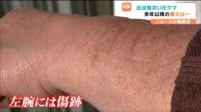 「熊と聞くだけで恐怖」左腕に残る引っかき傷 襲われた女性が語る後遺症「破傷風の注射、安定剤も飲んでいる」次の大量出没は2年後? |TBS NEWS DIG