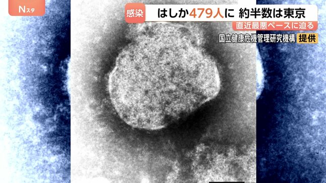 今年のはしか感染者数479人 前年同期比4.1倍に 東京都が約半分の人数占める|TBS NEWS DIG