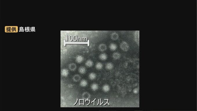 三寒四温で免疫力低下…ノロウイルスなどによる感染性胃腸炎にご用心　島根県は「冬季の食中毒注意報」発表|TBS NEWS DIG