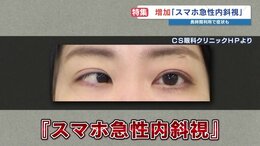 「スマホ急性内斜視」の子どもが急増　スマホの利用頻度が影響か|TBS NEWS DIG