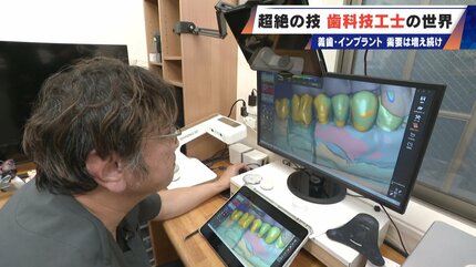 入れ歯難民”に？減り続ける歯科技工士 現役の約半数が50歳以上