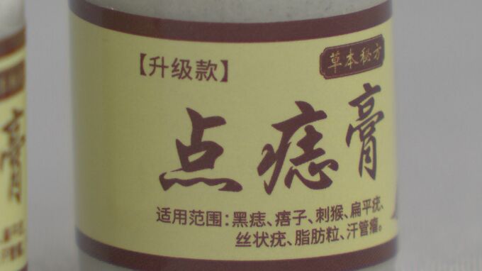 「皮膚がむけて変色した」海外製“ほくろ取りクリーム”「点痣膏」めぐり健康被害相談 国民生活センターが使用中止呼びかけ　SNS広告で「ひと塗りでホクロ除去」うたう|TBS NEWS DIG