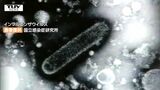 県が「インフルエンザ警報」を出す 患者数は前の週から倍増し1370人に(山形) | 山形のニュース│TUYテレビユー山形
