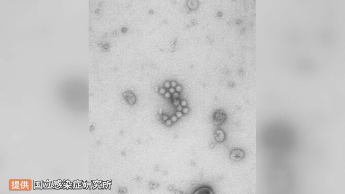 ノロウイルス集団食中毒相次ぐ　トイレでの感染、特に警戒を…医師指摘　トイレの水洗レバーにもウイルス付着　SNSで度々話題…「トイレットペーパー三角折」はやめた方が良い？　|　BSSニュース | BSS山陰放送