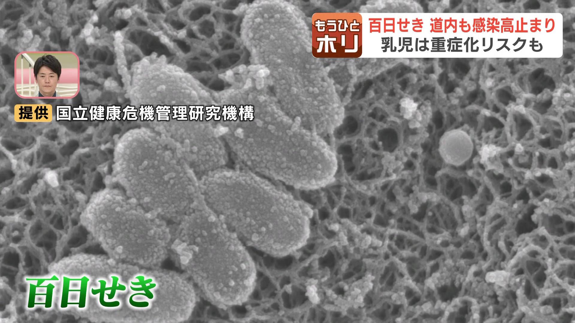 麻生 幾 38℃ 北京SARS医療チーム「生と死」の100日 1時間ごとに苦しくて飛び起きる」 激しいせきが続く「百日せき