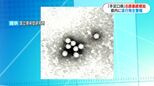 手足口病の感染者8週連続で増加　先週から県内全域に流行発生警報　鹿児島県|TBS NEWS DIG