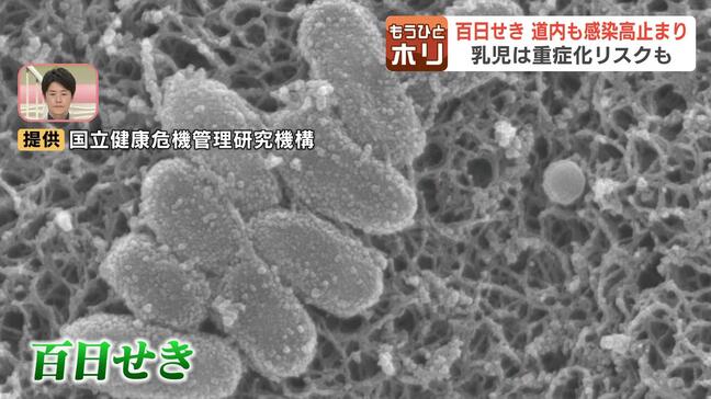 「1時間ごとに苦しくて飛び起きる」 激しいせきが続く「百日せき」 北海道でも感染者数が高止まり 症状が出た場合には、マスクの着用を徹底し早めの受診を|TBS NEWS DIG