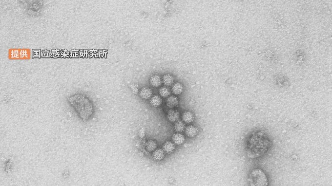 相次ぐノロウイルスによる集団食中毒…「感染性胃腸炎」流行中　感染力非常に強いノロウイルス、特効薬はなく対症療法…有効な対策は？　|　BSSニュース | BSS山陰放送