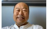 佐野慈紀さん 「まだまだ思うようには行かない」 退院後の状況明かす 「やっぱりハードルは高い」 今年5月に右腕切断手術|TBS NEWS DIG