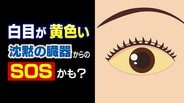 「白目が黄色い」は “沈黙の臓器” からのSOSかも 放置は厳禁 専門医が教える病気のサインと日常生活に潜む要因　|　富山のニュース｜天気・防災｜チューリップテレビ