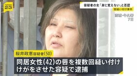 「身に覚えがありません」同居女性の唇縫い付けた疑いの女が容疑を否認　2人の関係性について捜査進める|TBS NEWS DIG