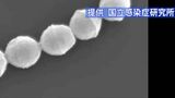 溶連菌による咽頭炎が前年同期の約6倍に…流行性角結膜炎やプール熱も例年以上の拡大、新型コロナは横ばい続く | SBC NEWS | 長野のニュース | SBC信越放送