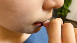 「爪噛み症」なぜ噛んでしまうのか?…皮膚科医・小児科医と考える 身体への影響は?対処法は?「爪噛みは親の愛情不足」は迷信|TBS NEWS DIG