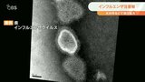インフルエンザ感染拡大 学級閉鎖も 県が注意報発表 大分 | 大分のニュース|OBS NEWS|大分放送