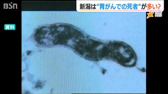 「塩分摂取やピロリ菌との関係は？」新潟県は胃がんによる死亡率が全国ワースト7位【新潟ケンジュプロジェクト】|TBS NEWS DIG