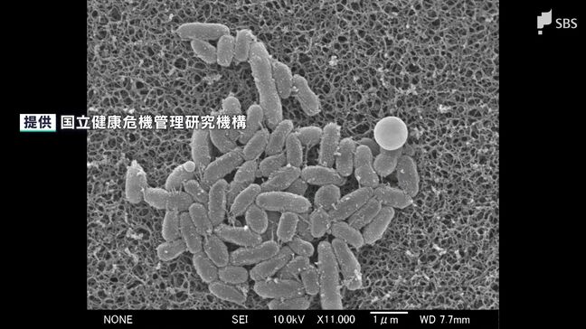 「小さい子どもは症状が非常に強くなる」“百日ぜき”の流行止まらず 患者数は3週連続で過去最多 対策は…ワクチン、早期受診、マスク=静岡|TBS NEWS DIG