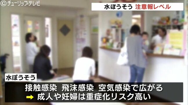 富山県内で水ぼうそうが注意報レベル　ワクチン接種で感染予防を|TBS NEWS DIG