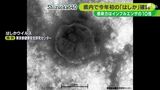 浜松市で4年ぶりに「はしか」の患者確認 海外から帰国の30代男性 県内では2023年初【速報】 | 静岡のニュース | SBSNEWS | 静岡放送