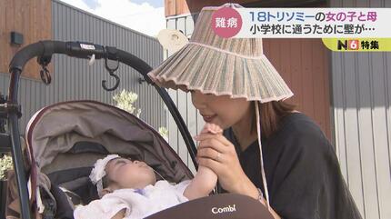 1歳まで生きられるのは1割の難病 ″18トリソミー″ 6歳の女の子 富山でも