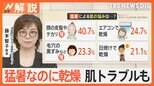 猛暑なのに乾燥肌 トラブルも… 汗かいた後どうしている? あせも・汗かぶれ どうしたら?【Nスタ解説】|TBS NEWS DIG