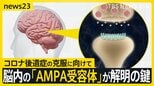 コロナ後遺症「ブレインフォグ」克服の糸口につながる研究結果 患者の脳を分析「アンパ受容体」の密度が健常者より高いと判明 横浜市立大学病院 新たな臨床試験も【news23】|TBS NEWS DIG