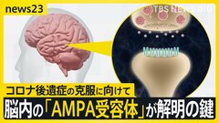 コロナ後遺症「ブレインフォグ」克服の糸口につながる研究結果 患者の脳を分析「アンパ受容体」の密度が健常者より高いと判明 横浜市立大学病院 新たな臨床試験も【news23】| TBS CROSS DIG with Bloomberg