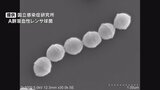 人食いバクテリア「劇症型溶血性レンサ球菌感染症」 今年確認7人のうち2人死亡 山梨県|TBS NEWS DIG