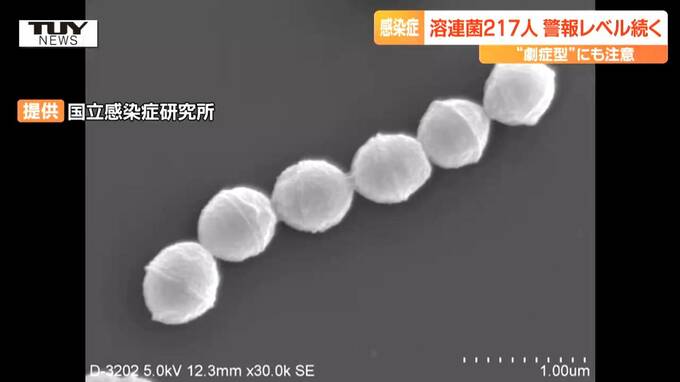 ”劇症型溶連菌”去年を上回り過去最悪ペース　感染経路は分からず　傷口や粘膜から感染　消毒などの対策を（山形）　|　山形のニュース│TUYテレビユー山形