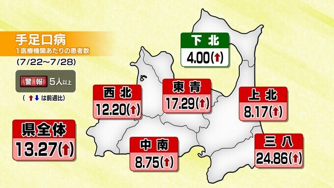 「手足口病」の感染拡大　青森県内の5つの管内に「警報」　患者数が前週より262人増　|　青森のニュース│ATV NEWS│青森テレビ