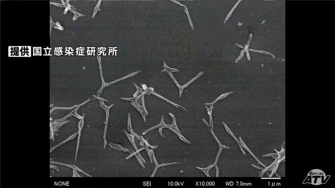 「マイコプラズマ肺炎」患者が1医療機関あたり『5人』に　全国2番目の多さの青森県　マスクの着用や手洗いの徹底を　|　青森のニュース│ATV NEWS│青森テレビ