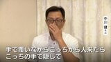 【見た目問題】「“普通”に憧れ続けた」口唇口蓋裂の52歳男性　口元隠した過去を乗り越えて　「中身が好き」と言える妻と掴んだ幸せ　富山|TBS NEWS DIG