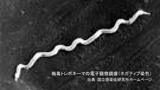 梅毒感染が最多だった去年の2倍ペースで増加 過去10年で最多に「無料で相談・検査ある 気になる人は早期受診を」【長崎】 | 長崎のニュース | 天気 | NBC長崎放送