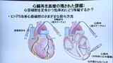 全国120万人の心不全患者に朗報となるか iPS細胞を使ってサルの心臓再生に成功 信州大学が慶應義塾大学などと共同で発表 県内初となる人への臨床治験に向け準備 | SBC NEWS | 長野のニュース | SBC信越放送