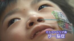 難病・リー脳症の息子(8)と母「そうなんだ、治らんのや」医療的ケア児の“学校付き添い”という問題、法改正しても…|TBS NEWS DIG