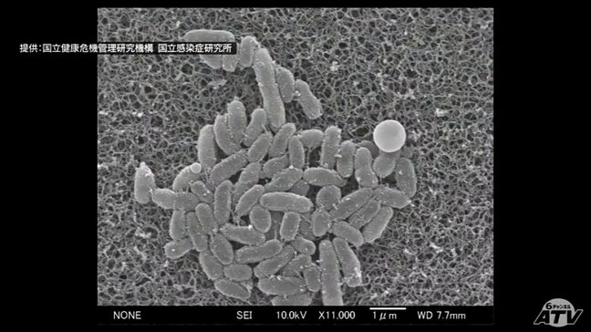 「百日咳」が青森県内でも流行 1週間の患者数は22人で過去最多に 地域別では「三八」が20人で最多に|TBS NEWS DIG