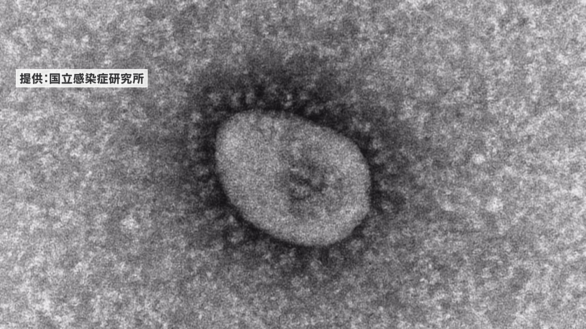 サムネイル_新潟県の新規感染者 新発田市で20人、上越市で19人など 新型コロナウイルス