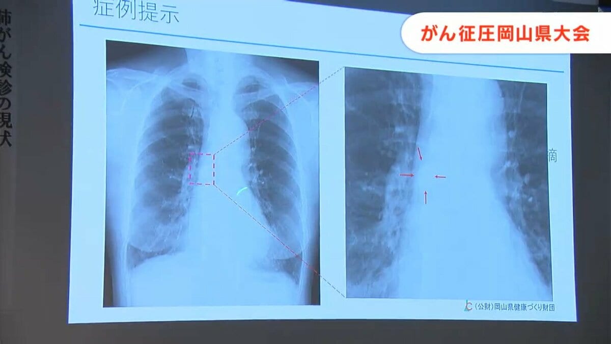 検診を受けてぜひ早期の治療に」 がん征圧岡山県大会 ガン征圧に功労の