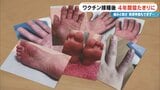 「油に足を突っ込んでいる感じ」 新型コロナワクチン接種後 4年間寝たきりに 止まらない“痛みと熱さ” 救済申請もできず… 後遺症に苦しむ患者たち | 名古屋・愛知・岐阜・三重のニュース【CBC news】 | CBC web